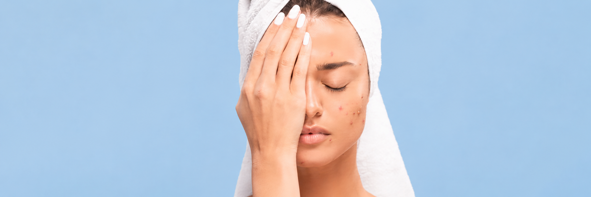 How Hard Water Can Cause Acne
