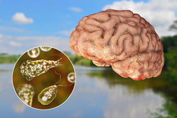 Brain-Eating Amoeba Kills Florida Resident: What Can You Do to Protect Yourself?